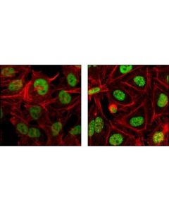 Cell Signaling Rpa70/Rpa1 (4d9) Rat mAb
