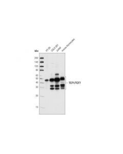 Cell Signaling Tcf1/Tcf7 (C46c7) Rabbit mAb
