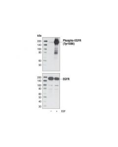 Cell Signaling Phospho-Egf Receptor (Tyr1086) Antibody