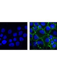 Cell Signaling Phospho-Egf Receptor (Tyr1045) Antibody