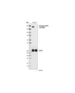Cell Signaling Egf Receptor (Egfr1) Mouse mAb (Ip Specific)