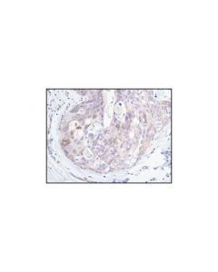 Cell Signaling Pp2a B Subunit (100c1) Rabbit mAb