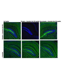 Cell Signaling Phospho-Alpha-Synuclein (Ser129) (D1r1r) Rabbit mAb