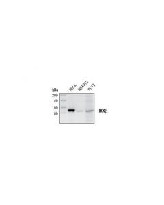 Cell Signaling Ikkbeta (2c8) Rabbit mAb