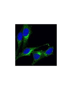 Cell Signaling Clathrin Heavy Chain (P1663) Antibody