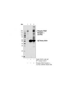Cell Signaling Phospho-Pdgf Receptor Alpha (Tyr762) (D9b1n) Rabbit mAb