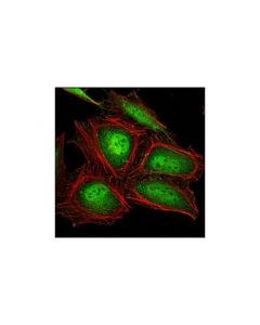 Cell Signaling Psma5 (K231) Antibody