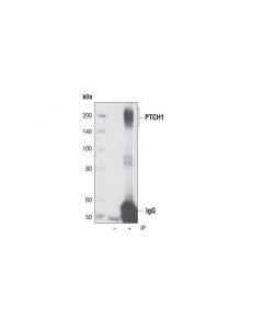 Cell Signaling Ptch1 (C53a3) Rabbit mAb