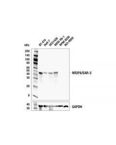 Cell Signaling Nr2f6/Ear-2 (E7q7g) Rabbit mAb