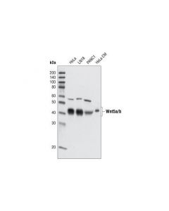 Cell Signaling Wnt5a/B (C27e8) Rabbit mAb