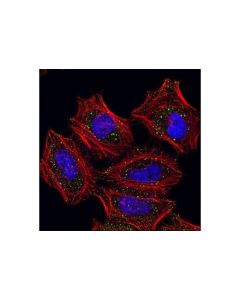 Cell Signaling Edc4/Ge-1 Antibody