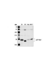 Cell Signaling P27 Kip1 Antibody