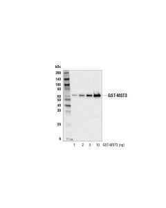 Cell Signaling Gst (91g1) Rabbit mAb