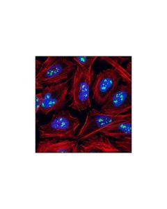 Cell Signaling Fibrillarin (C13c3) Rabbit mAb