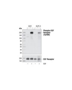 Cell Signaling Phospho-Egf Receptor (Tyr998) (C24a5) Rabbit mAb