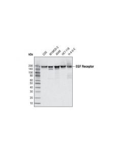 Cell Signaling Egf Receptor (C74b9) Rabbit mAb