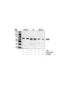 Cell Signaling Chk2 Antibody