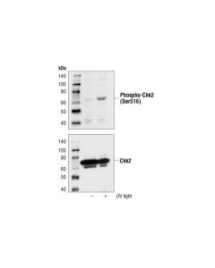 Cell Signaling Phospho-Chk2 (Ser516) Antibody