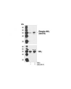 Cell Signaling Ikkgamma (Da10-12) Mouse mAb