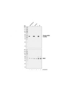 Cell Signaling Phospho-Mek1 (Thr292) (D5l3k) Rabbit mAb