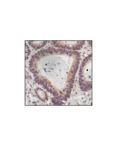 Cell Signaling P70 S6 Kinase (49d7) Rabbit mAb