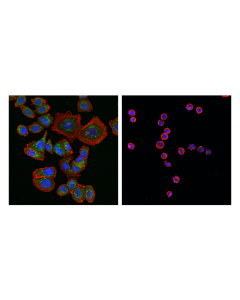 Cell Signaling Beta-Galactosidase (E2u2i) Rabbit mAb