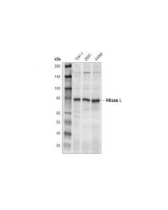 Cell Signaling Rnase L (D4b4j) Rabbit mAb