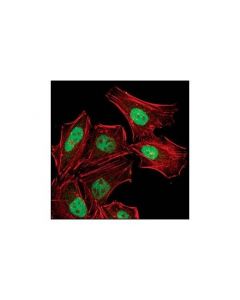 Cell Signaling Atrip Antibody
