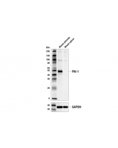 Cell Signaling Pai-1 Antibody