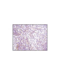 Cell Signaling Lyn (C13f9) Rabbit mAb