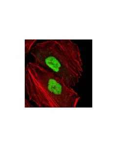 Cell Signaling Set7/Set9 Antibody