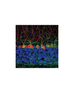 Cell Signaling Neurofilament-H (Rmdo 20) Mouse mAb