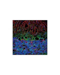Cell Signaling Neurofilament-L (C28e10) Rabbit mAb