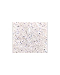 Cell Signaling Neurofilament-M (Rmo 14.9) Mouse mAb