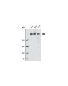 Cell Signaling Atm (D2e2) Rabbit mAb