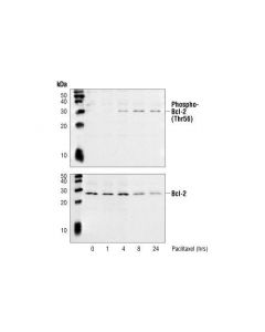 Cell Signaling Phospho-Bcl-2 (Thr56) Antibody (Human Specific)