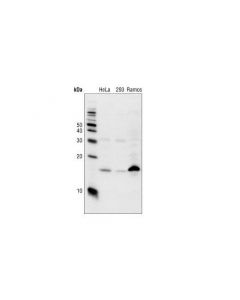 Cell Signaling P18 Ink4c (Dcs118) Mouse mAb