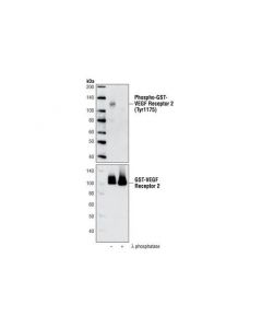 Cell Signaling Vegf Receptor 2 Control Proteins