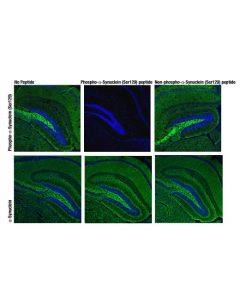 Cell Signaling Phosphoplus Alpha-Synuclein (Ser129) Antibody Duet