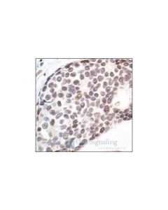Cell Signaling Cdk7 (Mo1) Mouse mAb