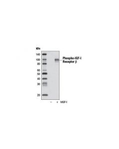 Cell Signaling Phospho-Igf-I Receptor Beta (Tyr1135/1136)/Insulin Receptor Beta (Tyr1150/1151) (19h7) Rabbit mAb (Biotinylated)