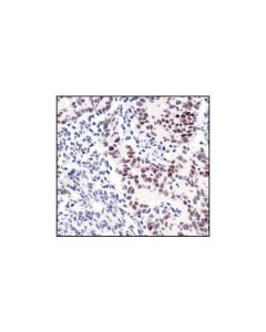 Cell Signaling Cyclin D1 (92g2) Rabbit mAb