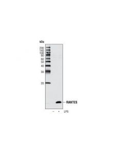 Cell Signaling Ccl5/Rantes (P20) Antibody