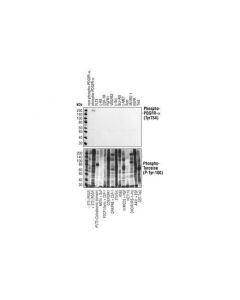 Cell Signaling Phospho-Pdgf Receptor Alpha (Tyr754) (23b2) Rabbit mAb