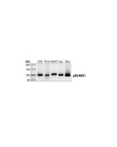 Cell Signaling P95/Nbs1 Antibody