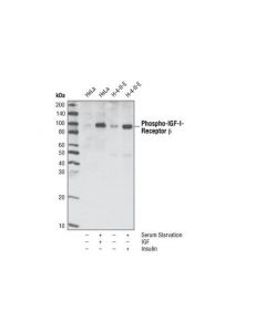 Cell Signaling Phospho-Igf-I Receptor Beta (Tyr1135/1136)/Insulin Receptor Beta (Tyr1150/1151) (19h7) Rabbit mAb
