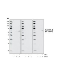 Cell Signaling Acetyl-Nf-Kappab P65 (Lys310) Antibody