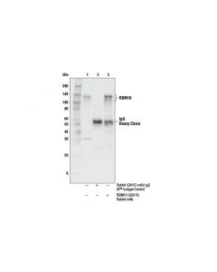 Cell Signaling Rbm10 (E6i1r) Rabbit mAb