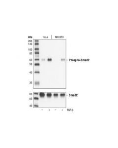 Cell Signaling Phospho-Smad2 (Ser465/467) (138d4) Rabbit mAb