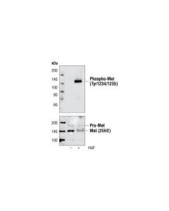 Cell Signaling Phospho-Met (Tyr1234/1235) (3d7) Rabbit mAb